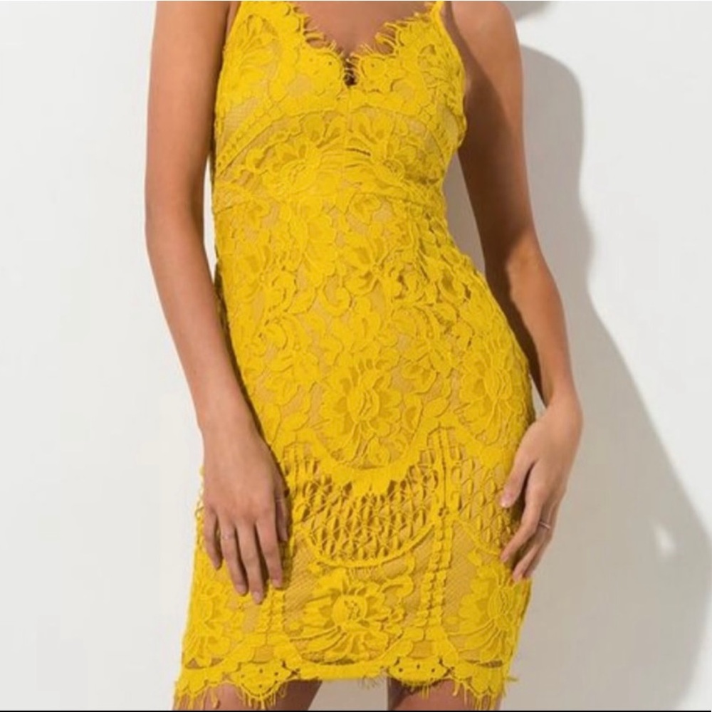 Yellow Lace Midi Dress